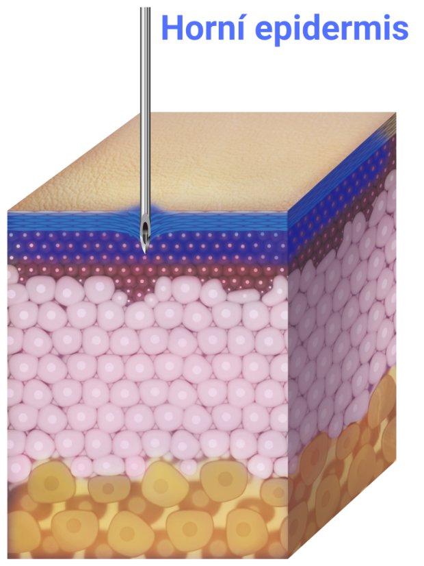 TURTLEPIN Injekční aplikátor  19 jehel / 0,5 mm / 32 G - 20 ks