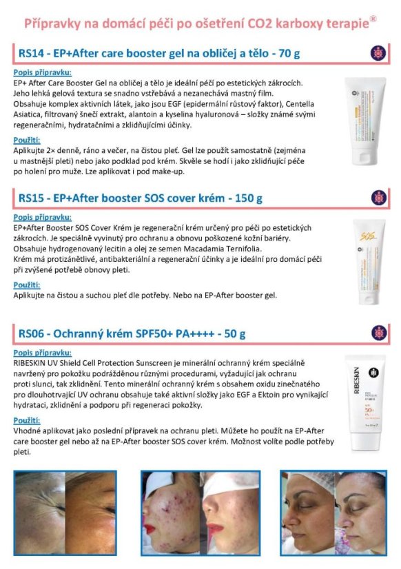 CO2 karboxy terapie - leták A5 - 1 ks
