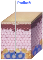 TURTLEPIN Injekční aplikátor  7 jehel / 3,0 mm / 32 G - 20 ks