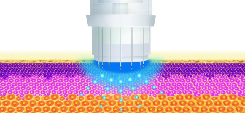 Deep shoot HA sérum - hydratace - hloubka vpichu 0,5 mm - 5 x 3 ml